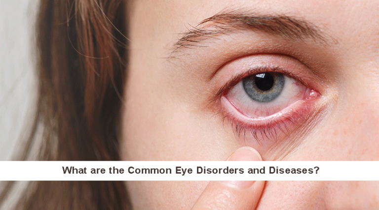 Common Eye Disorders and Diseases?